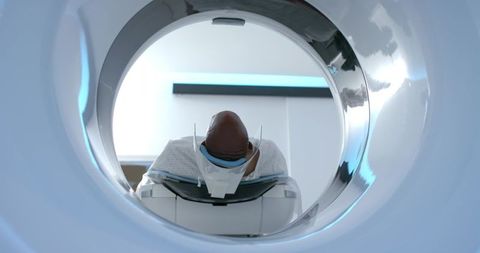 African american man undergoing mri head scan wearing thermoplastic immobilizer and gown