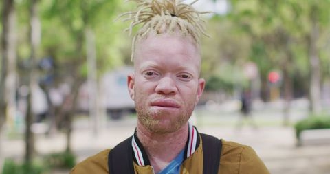 Albino Man with Dreadlocks Outdoors in Urban Park