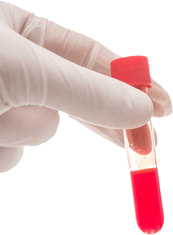 transparent hand holding blood test tube for medical analysis - Download Free Stock Videos Pikwizard.com