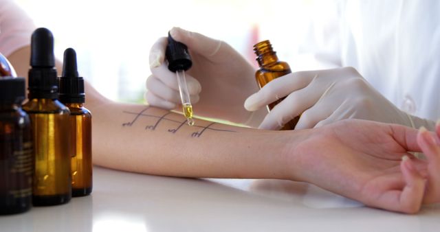 Doctor Administering Allergy Test with Droppers on Patient's Arm - Download Free Stock Images Pikwizard.com