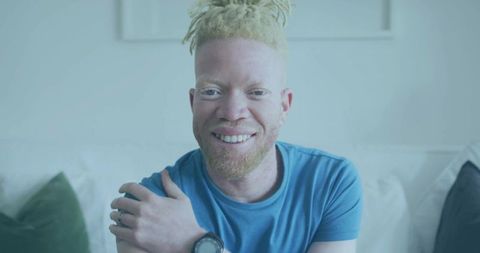 Smiling Man with Albinism Comfortable at Home Wearing Blue T-Shirt