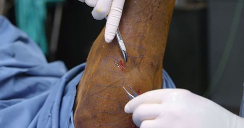 Veterinary Surgeon Stitching Surgery on Horse's Leg Close-Up