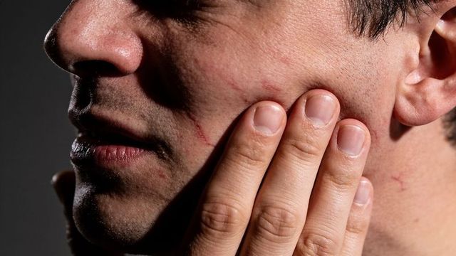 Young man touching cheek with hand showing facial scratches and stubble in dramatic closeup