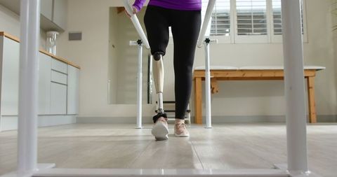 Woman Walking with Prosthetic Leg in Rehabilitation Room
