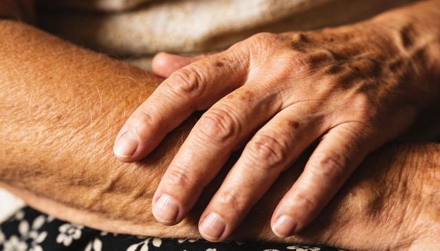Elderly hands resting on lap showing wrinkles, veins and age spots, intimate closeup