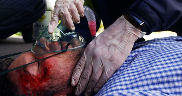 Emergency Response Treating Injured Man with Oxygen Mask and Wound - Download Free Stock Photos Pikwizard.com