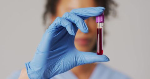Doctor Holding Blood Sample in Laboratory Gloved Hand Close-up - Download Free Stock Images Pikwizard.com