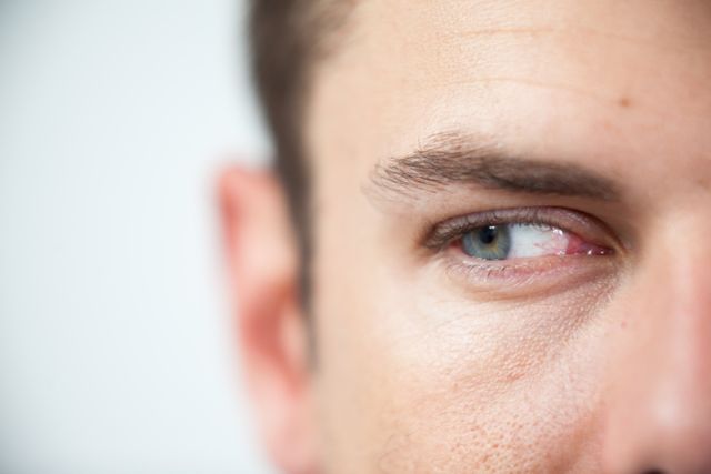 Close-up detail of a man's blue eye, showcasing a contact lens. Perfect for use in healthcare, vision correction, optical product advertisements, or articles about eye health and contact lenses.