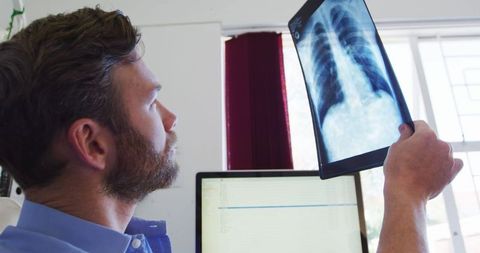 Male Doctor Analyzing Radiograph in Medical Office Environment