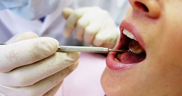 Dentist Examining Female Patient's Teeth with Dental Mirror - Download Free Stock Images Pikwizard.com