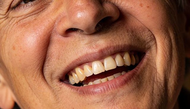 Close-up smiling senior man showing natural teeth, smile lines and skin texture