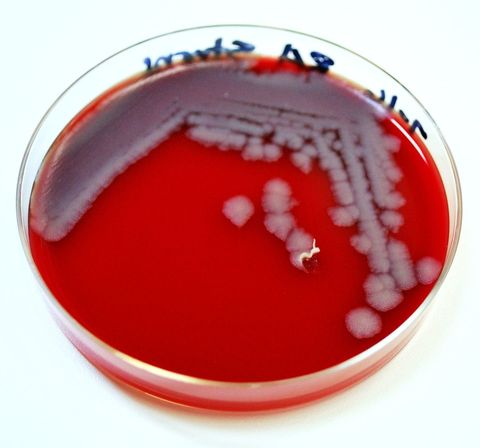 Bacterial Colony in Petri Dish on Red Agar Surface