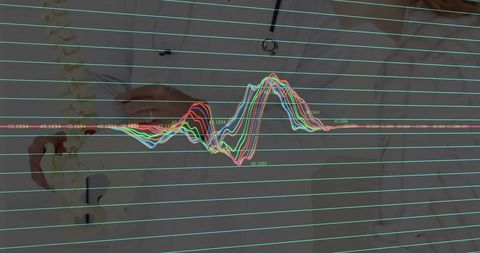 Doctor holding spine model with dynamic medical graph overlay