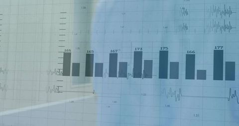 Blue medical monitor displaying bar chart with ecg waveform overlay and glass reflection