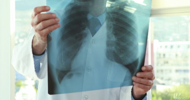 Doctor Analyzing Chest X-Ray in Medical Office - Download Free Stock Images Pikwizard.com