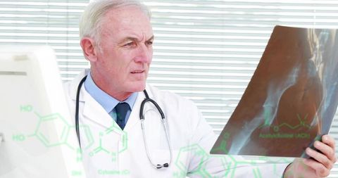Senior Doctor Holding Hip X-Ray and Analyzing Results with Stethoscope and Medical Graphics