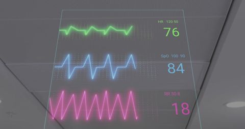 Heart rate and vital signs display in modern hospital environment