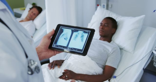 Doctor showing patient chest X-rays on digital tablet in hospital ward - Download Free Stock Images Pikwizard.com