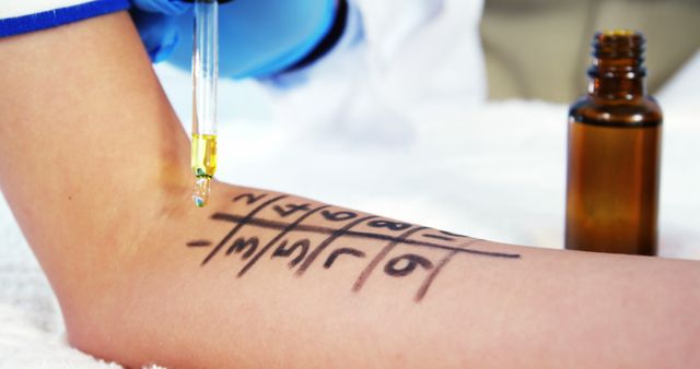 Conducting Allergy Skin Test with Allergens on Forearm - Download Free Stock Images Pikwizard.com