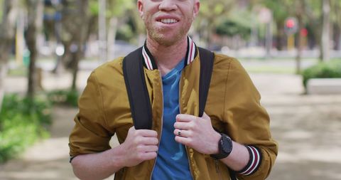 Confident Albino Man with Dreadlocks Enjoying Park Walk