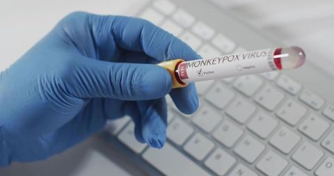 Blue gloved hand holding positive monkeypox blood sample tube over computer keyboard