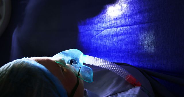 Ideal for use in medical-related articles, healthcare blogs, hospital training materials, and websites focused on surgeries and patient care. The image shows the importance of oxygen masks during medical procedures, highlighting critical care scenarios. The blue lighting emphasizes a sterile environment.