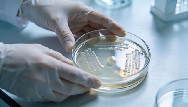 Holding sterile petri dish with streaked bacterial colonies for microbiology research