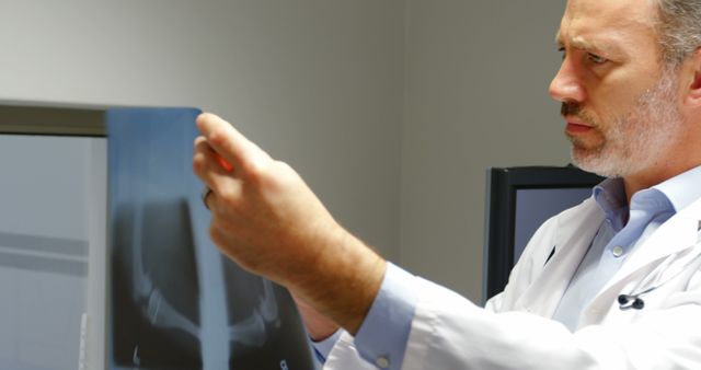 Doctor Analyzing Patient X-ray in Diagnostic Clinic - Download Free Stock Images Pikwizard.com