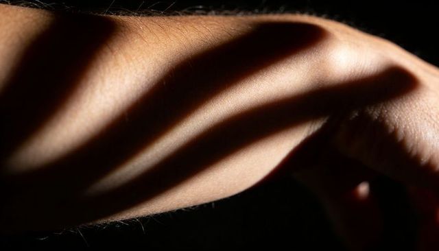 Dramatic finger-shadow stripes across brown forearm with textured studio light