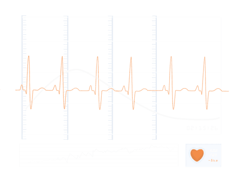 digital heartbeat monitor illustration on transparent background - Download Free Stock Videos Pikwizard.com