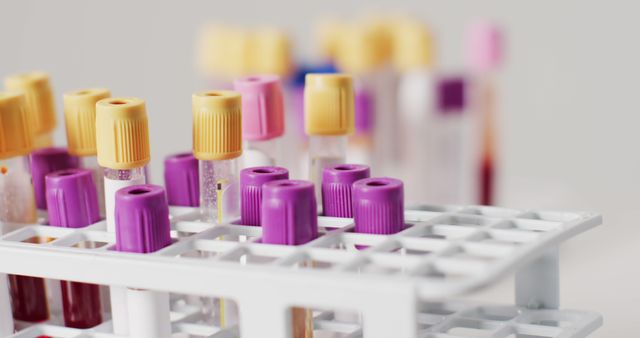 Test tubes with various colored caps filled with blood and other fluids on a white rack in a lab. Suitable for use in content related to medical research, scientific studies, healthcare industries, lab testing, and educational materials.
