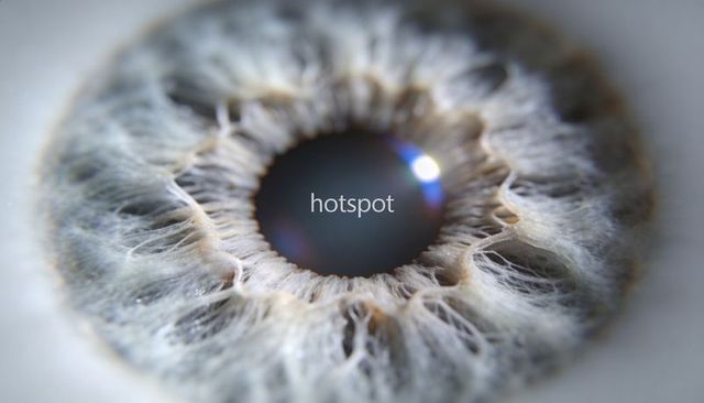 Macro human iris close-up showing radial fibers, specular glint and hotspot overlay