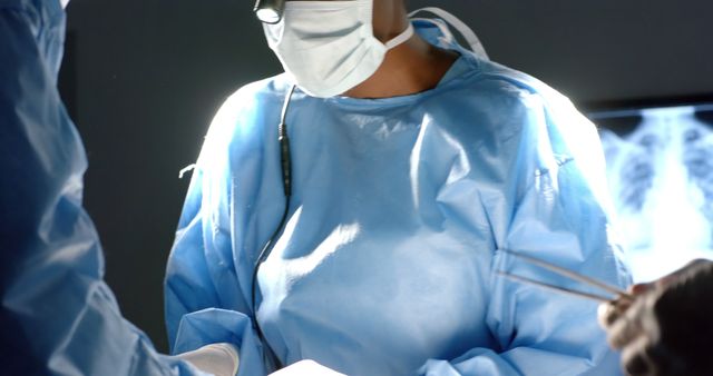 A surgeon wearing blue scrubs, a mask, and gloves is focused on operating inside a well-lit and sterile operating room. The surgical lights highlight the meticulous work of the medical professionals involved. Ideal for use in medical, healthcare, and surgical procedure-related content, emphasizing the importance of precision, expertise, and teamwork in the operating room. Suitable for articles, advertisements, and educational materials about healthcare, medical procedures, and hospital environments.