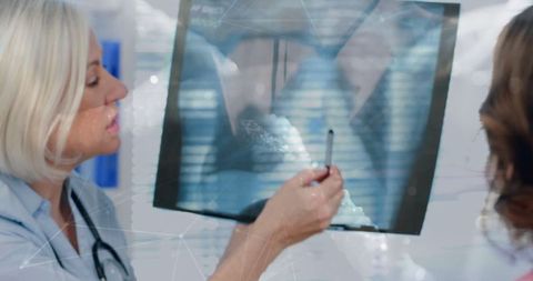 Doctor explaining x-ray results with pen at clinic