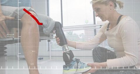 Fitting prosthetic leg and sneaker during rehabilitation with augmented reality analytics