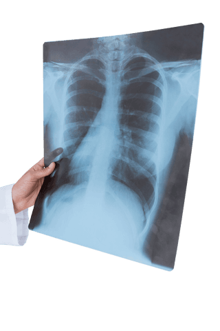 Medical professional examining transparent x-ray film