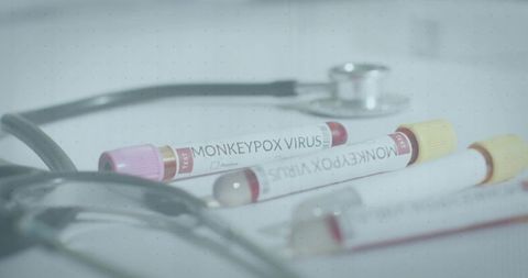 Monkeypox virus blood sample tubes and stethoscope clinical laboratory diagnostic concept