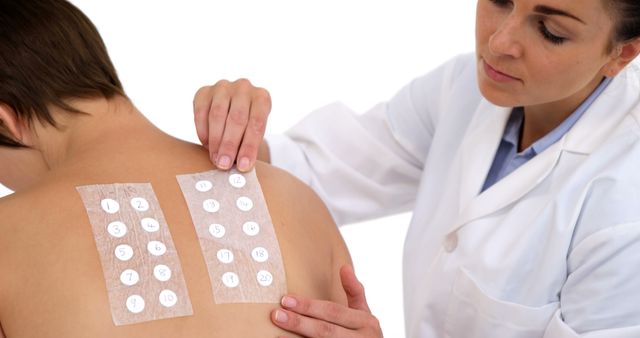 A healthcare professional is administering an allergy skin test to a patient, with copy space. In a clinical setting, the test helps identify specific allergens that may cause allergic reactions in the patient.