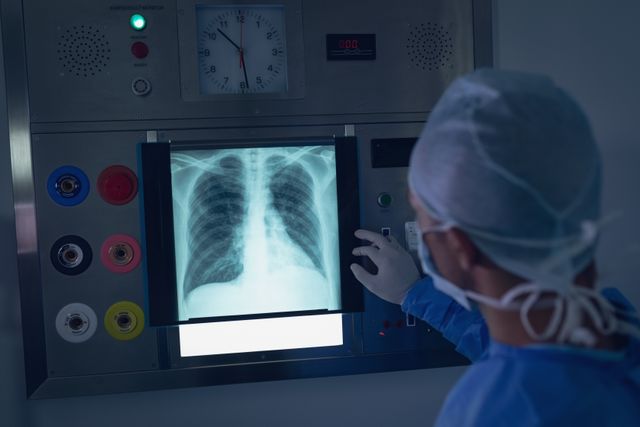 Surgeon in operation theater examining chest x-ray on light box. Useful for medical, healthcare, and hospital-related content. Ideal for illustrating medical diagnosis, patient care, and surgical procedures.