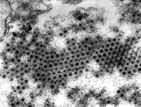 Detailed transmission electron microscopy of honeycomb lattice structure