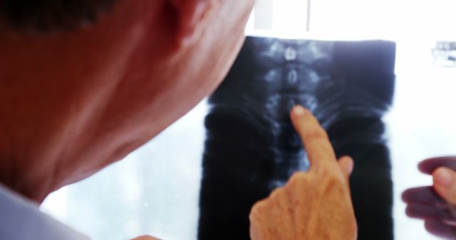 Doctor Pointing at Spinal X-Ray Film for Analysis - Download Free Stock Images Pikwizard.com