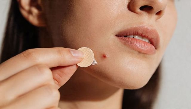 Woman applying hydrocolloid acne patch to cheek close-up skincare routine for blemish care