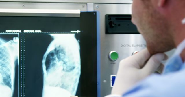Doctor examining x-ray images of patient on computer screen in modern medical facility. Useful for illustrating medical diagnosis, radiology practices, healthcare industry, hospital settings, patient treatment procedures, and technological advancement in medicine.