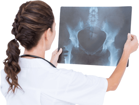 Female doctor examining transparent pelvic x-ray