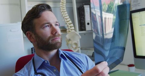 Male doctor examines x-ray in medical office with spine model