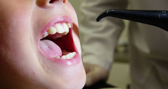 Close-up of a child at a dental checkup with their mouth wide open. This image is suitable for depicting dental visits, oral health awareness, dental hygiene practices, pediatric dentistry, or illustrating dental care and checkups in medical-related content.