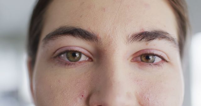 Close-up captures person's brown eyes and symmetrical eyebrows, showcasing natural skin with blemishes. Perfect for advertising skincare products, natural beauty campaigns, cosmetic tutorials, medical studies on skin conditions, or personal care blogs. Highlights authenticity and realistic human facial features.