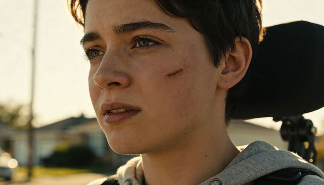 Contemplative teen in wheelchair wearing grey hoodie showing cheek abrasion, sunlit suburb