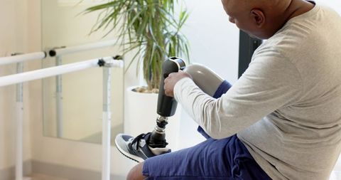 Man Fitting Prosthetic Leg Enhances Mobility in Rehabilitation Room