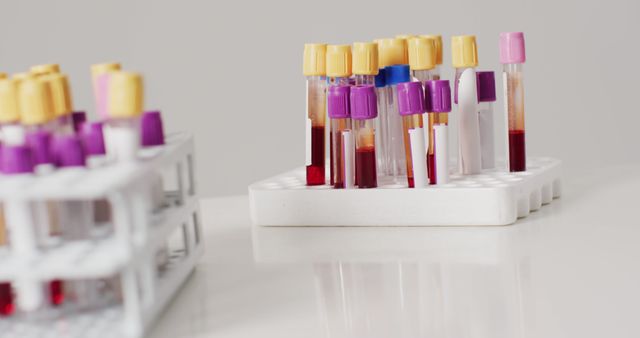 Blood Samples in Test Tubes on White Surface - Download Free Stock Images Pikwizard.com